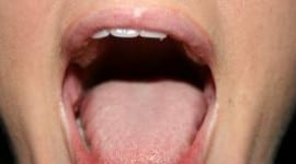 Απαλλαγείτε από την κακοσμία του στόματος