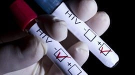 Ρεκόρ μολύνσεων από τον ιό HIV σε Ευρώπη και Ασία το 2014
