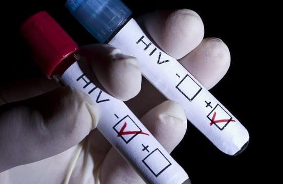 Ρεκόρ μολύνσεων από τον ιό HIV σε Ευρώπη και Ασία το 2014
